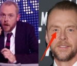 Simon Pegg Memiliki Warna Mata Berbeda