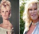 Jocelyn Wildenstein yang Terkenal dengan Julukan 'Cat Women' 