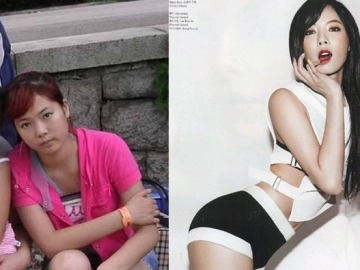 Sebelum dan Sesudah, Beginilah Perubahan 8 Wajah K-pop Idol Wanita Setelah Operasi Plastik