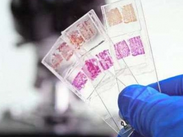  Lama Tersembunyi, Ilmuwan Temukan Ada Organ Baru di Tubuh Manusia 