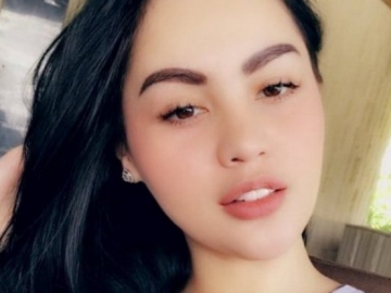 Foto Perawatan Jennifer Dunn di Dalam Rutan Beredar, Ini Kata Direktorat Pemasyarakatan