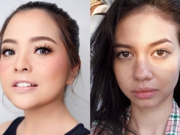 Kini Jadi Tren,10 Selebriti Ini Cantik dengan Make Up Freckles