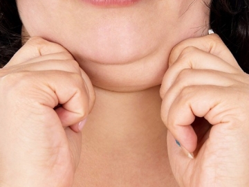 Double Chin Ganggu Foto Cantikmu? Hilangkan Dengan 6 Cara Mudah Ini