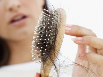 6 Penyakit Berbahaya Ini Bisa Jadi Penyebab Rambut Rontok pada Wanita