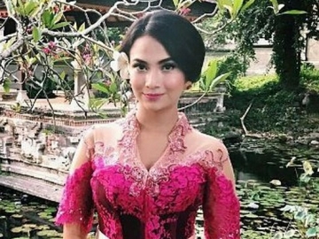 Sempat Pingsan Hingga Dilarikan ke RS, Vanessa Angel Kena Maag Akut dan Stress