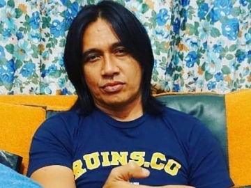 Penampilan Agung Hercules Berubah Drastis Lantaran Idap Kanker Otak, Sederet Artis Ini 'Nangis'