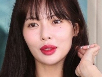 Balas Komentar Jahat Netizen, HyunA Bantah Lakukan Perawatan Untuk Mempertebal Bibir
