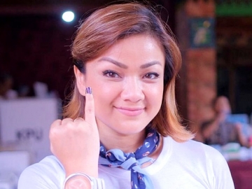 Punya Gingsul Malah Jadi Bahan Bullying, Nirina Zubir Langsung Cabut 4 Gigi dalam Sehari