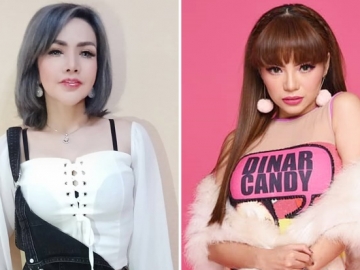 Barbie Kumalasari Bersitegang dengan Dinar Candy Gara-Gara Hidung Malah Dituding Gimik