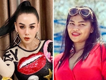 DJ Bebby Fey ‘Tambah’ Lesung Pipi, Direspons Beda dari Rosa Meldianti dan Barbie Kumalasari?