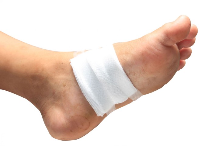 Image result for Luka yang Tak Kunjung Sembuh pada kaki