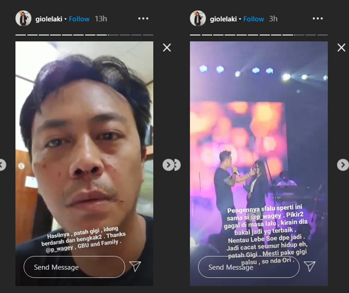 gio lelaki menunjukkan video dirinya tengah dianiaya oleh seornag wanita melalui akun Instagram pribadinya