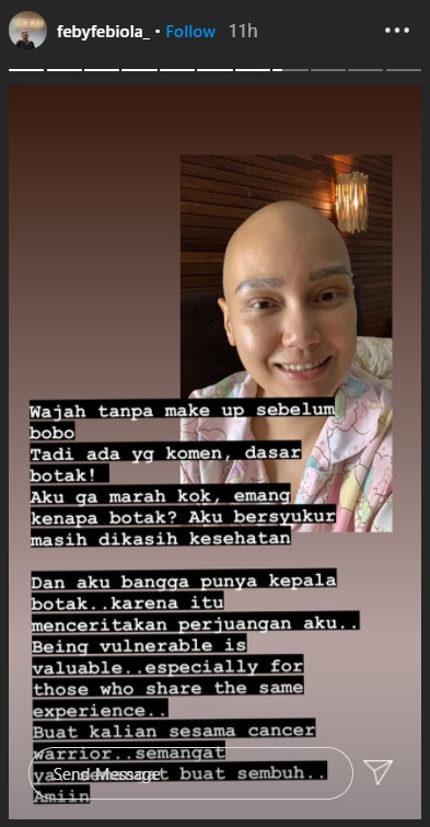 Feby Febiola Tak Marah Dicibir Karena Botak, Balik Beri Balasan Menyentuh