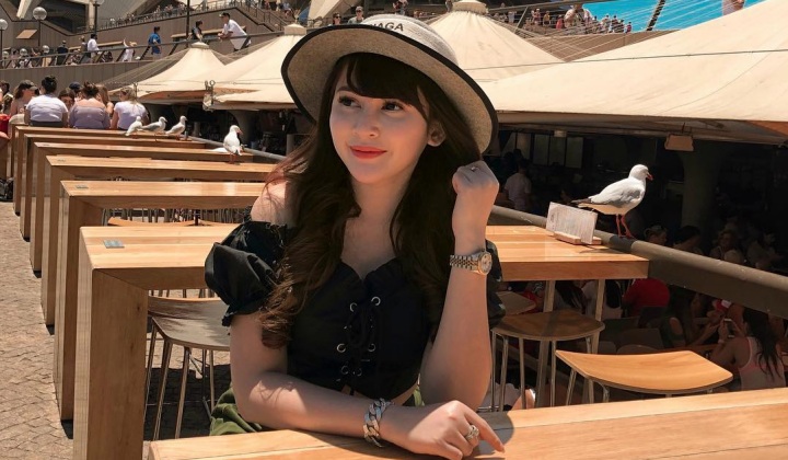 Dituding Lakukan Operasi Plastik Winny Putri Lubis Klarifikasi Dan Beber Fakta Ini